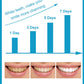 Teeth Whitening Pen for Instant White Teeth, Stain Remover- 5ml